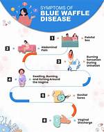 Unveiling the Truth About Blue Waffle Disease: Pictures Reveal Surprising Insights