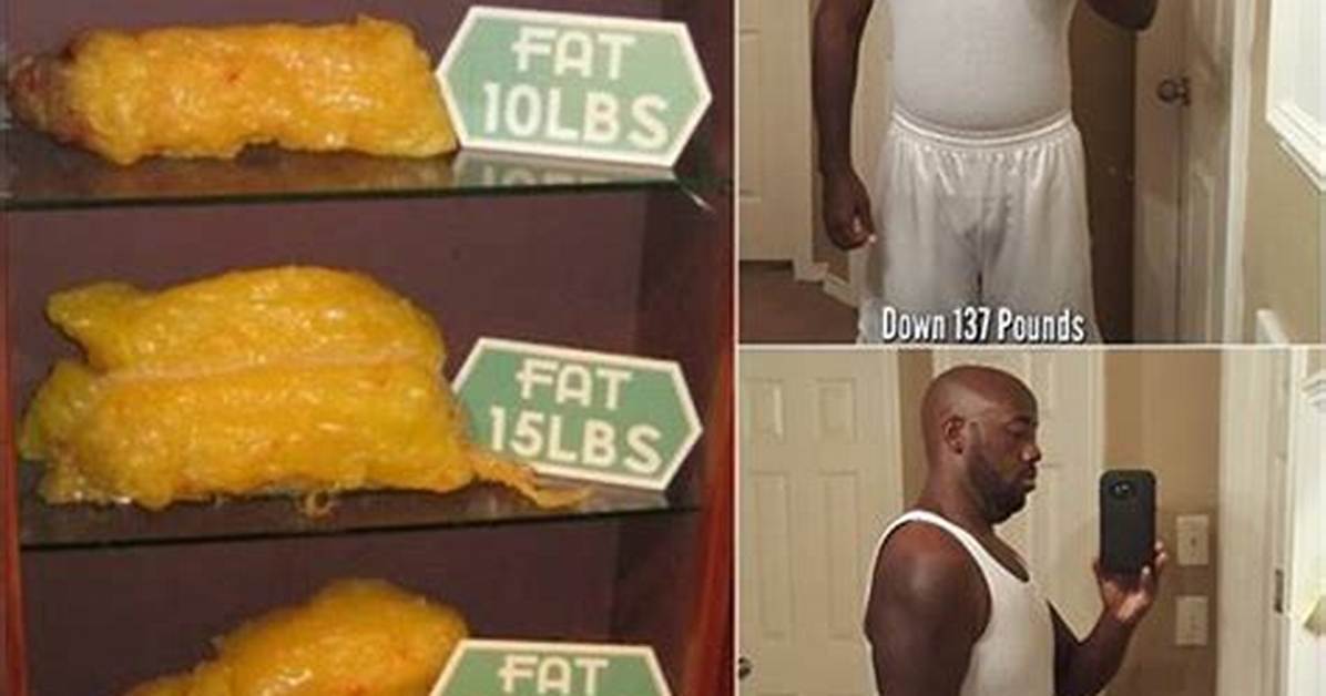What Does 60 Pounds of Fat Look Like