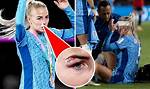 What Happened to Alex Greenwood Face? Injury Details and Family of the Man City Women Soccer Player ·