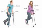 Where Do I Put My Crutches on a Plane? |