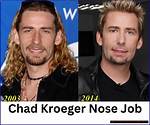 Where Is Chad Kroeger from: Unveiling the Origins of the Nickelback Frontman