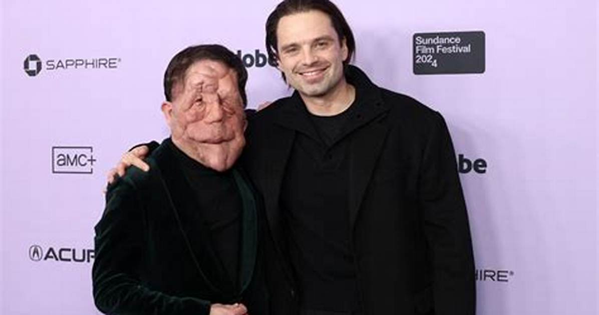 Who Is Adam Pearson's Girlfriend? a Deep Dive into His Relationship